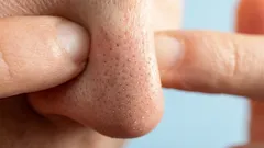 Este problema preocupa muitos, mas nem todos sabem que é fácil resolvê-lo.