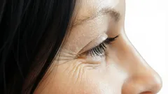 Por que aparecem rugas na zona dos olhos: cinco fatores a que quase ninguém presta atenção