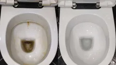 Não ficará qualquer vestígio das irritantes manchas amarelas: guarde estas 3 formas de limpar a sanita